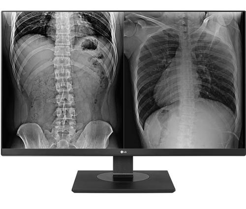 Monitor medical profesional IPS LED LG 27inch 27HJ713C-B, UHD (3840 x 2160), HDMI, DisplayPort, Pivot (Negru)